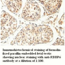 RBBP6 Antibody
