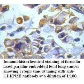 CDKN2B Antibody