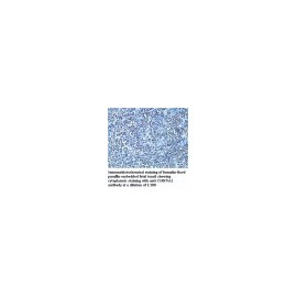 CHRNA1 Antibody