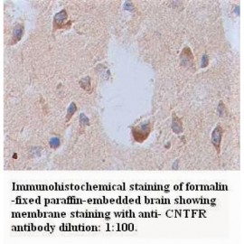 CNTFR Antibody
