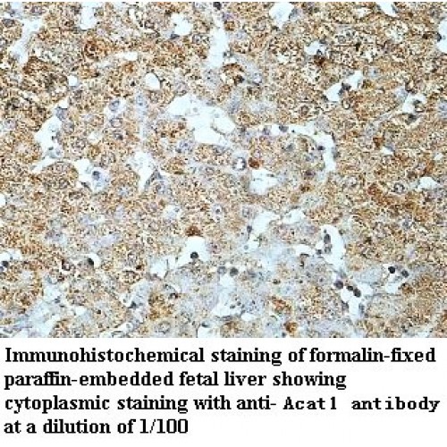 ACAT1 Antibody