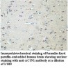 ACIN1 Antibody