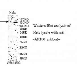 AP3D1 Gamma Antibody