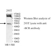 BCR Antibody