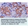 VEGF Gamma Antibody