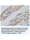 TNNI2 Gamma Antibody