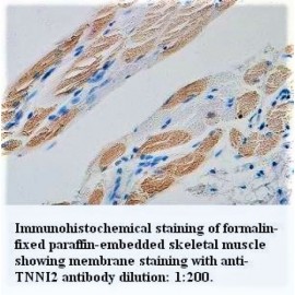TNNI2 Gamma Antibody