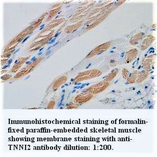 TNNI2 Gamma Antibody