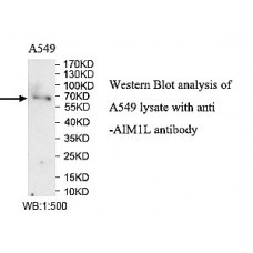AIM1L Antibody