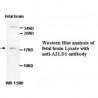 A2LD1 Antibody