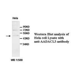  AADACL3 Antibody