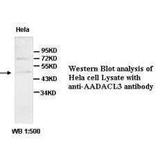  AADACL3 Antibody