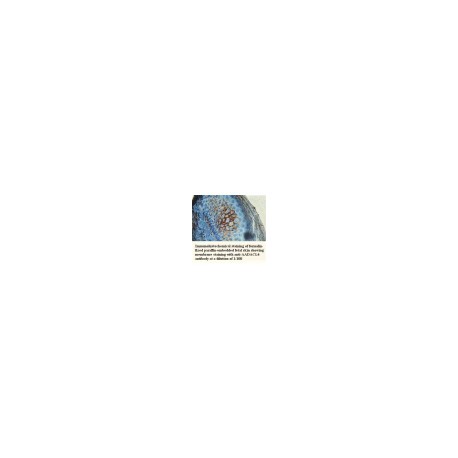  AADACL4Antibody