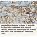 AATK Antibody