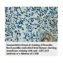 ABCA13 Antibody