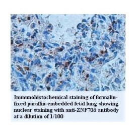 ZNF706 Antibody