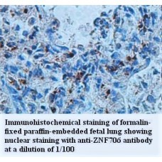 ZNF706 Antibody