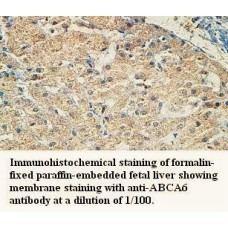 ABCA6 Antibody