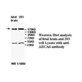 ABCA6 Antibody