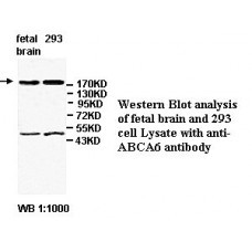 ABCA6 Antibody