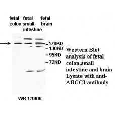 ABCC1 Antibody