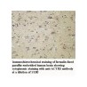 ACTBL3 Antibody