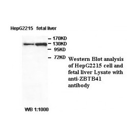 ZBTB34 Antibody