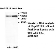 ZBTB34 Antibody