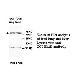 ZC3H12B Antibody