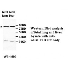 ZC3H12B Antibody