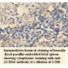 ACBD6 Antibody