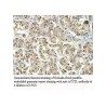 ACCSL Antibody