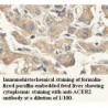 ACER2 Antibody