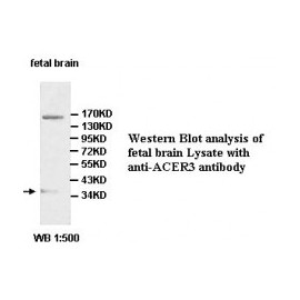 ACER3 Antibody