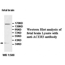 ACER3 Antibody