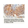 ACPT Antibody