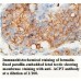 ACPT Antibody