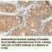  ACRBP Antibody