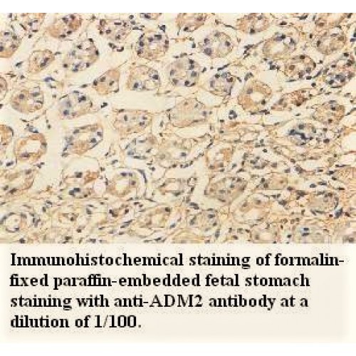ADM2 Antibody