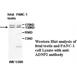 ADNP2 Antibody