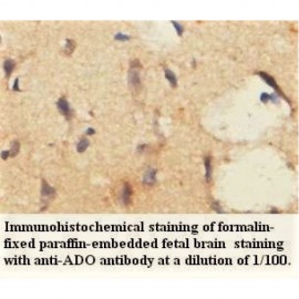 ADO Antibody