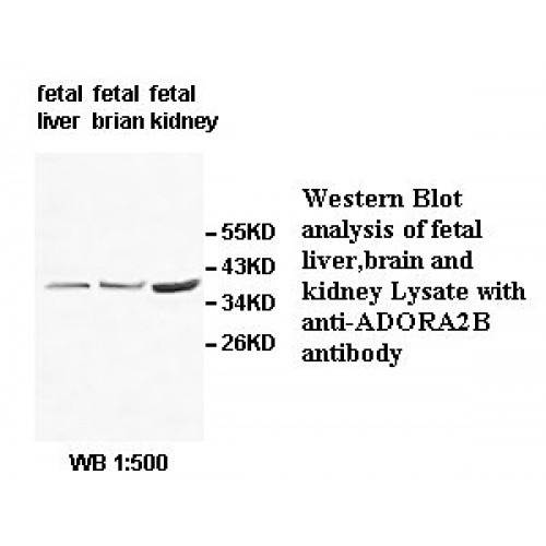 ADORA2B Antibody