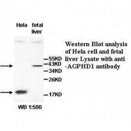 AGPHD1 Antibody