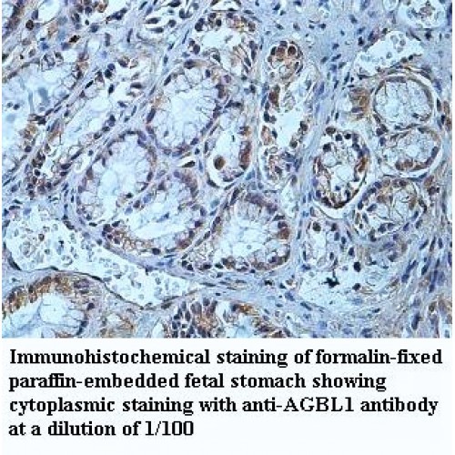 AGBL1 Antibody