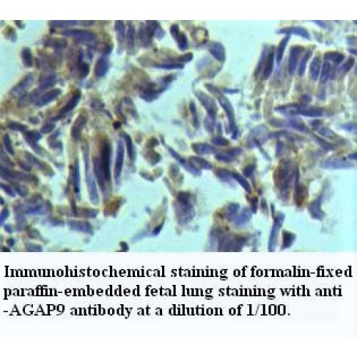 AGAP9 Antibody