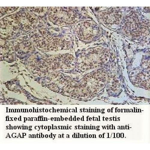 AGAP4 Antibody
