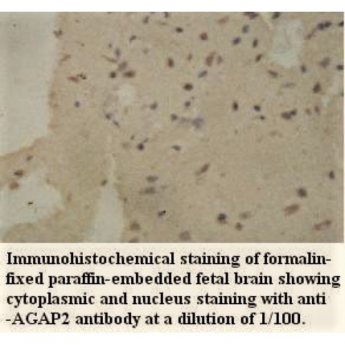 AGAP2 Antibody