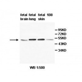 ABHD15 Antibody
