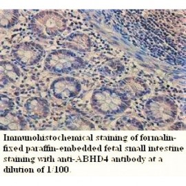 ABHD4 Antibody