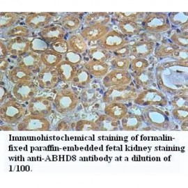 ABHD8 Antibody